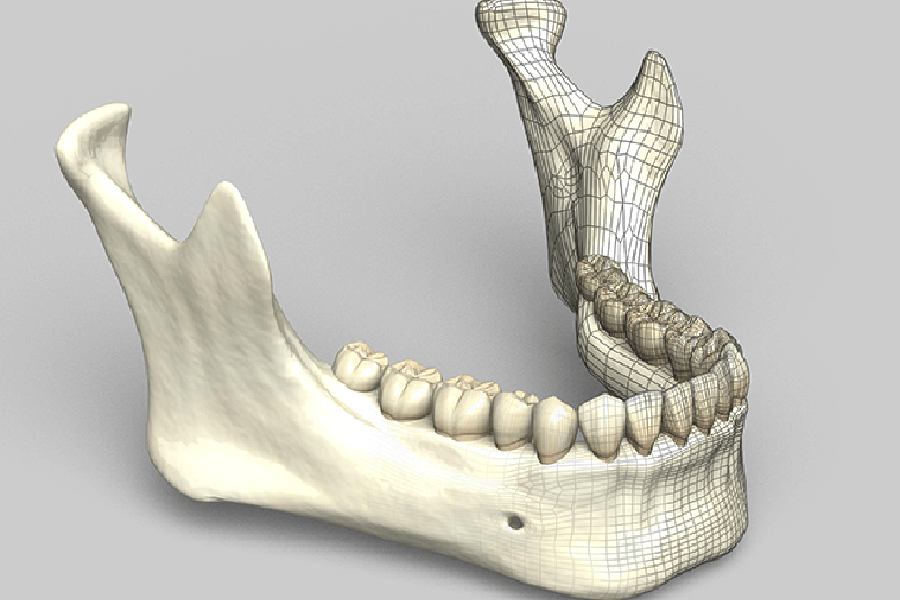 蒲田のインプラント専門医院、のびのび歯科・矯正歯科