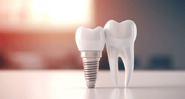 蒲田のインプラント専門医院、のびのび歯科・矯正歯科のインプラント手術の種類