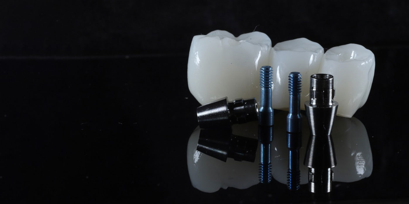 蒲田のインプラント専門医院、のびのび歯科・矯正歯科