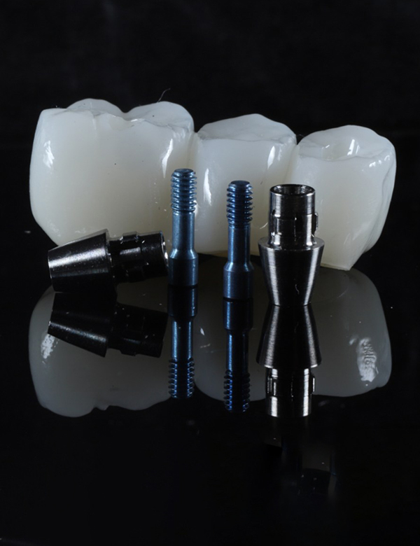 蒲田のインプラント専門医院、のびのび歯科・矯正歯科