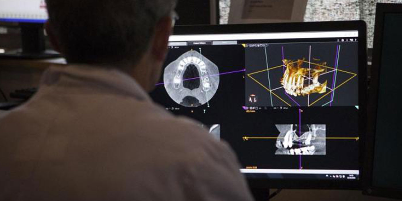 蒲田のインプラント専門医院、のびのび歯科・矯正歯科